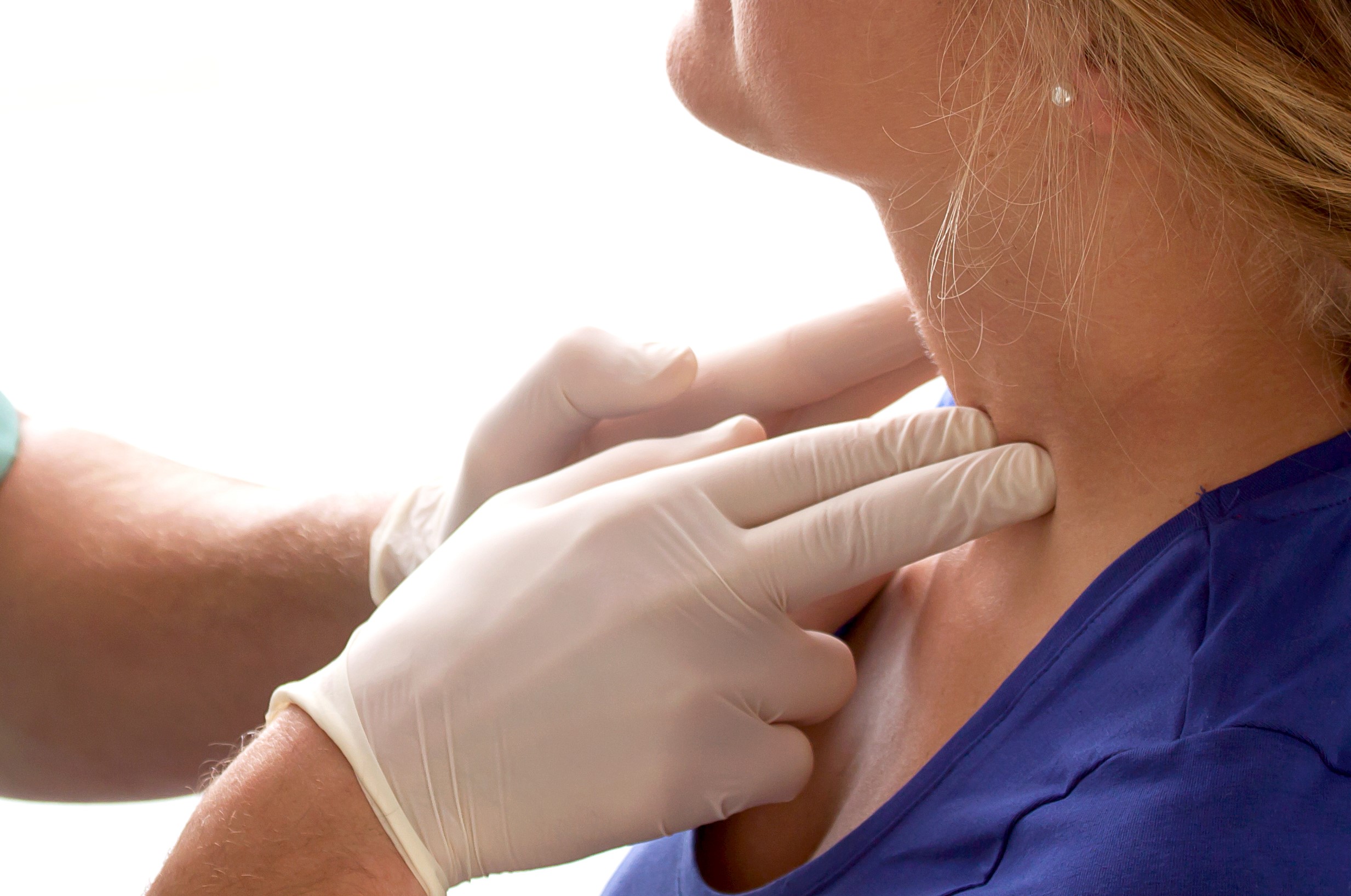 Image Peritonsillar Abscess treatment