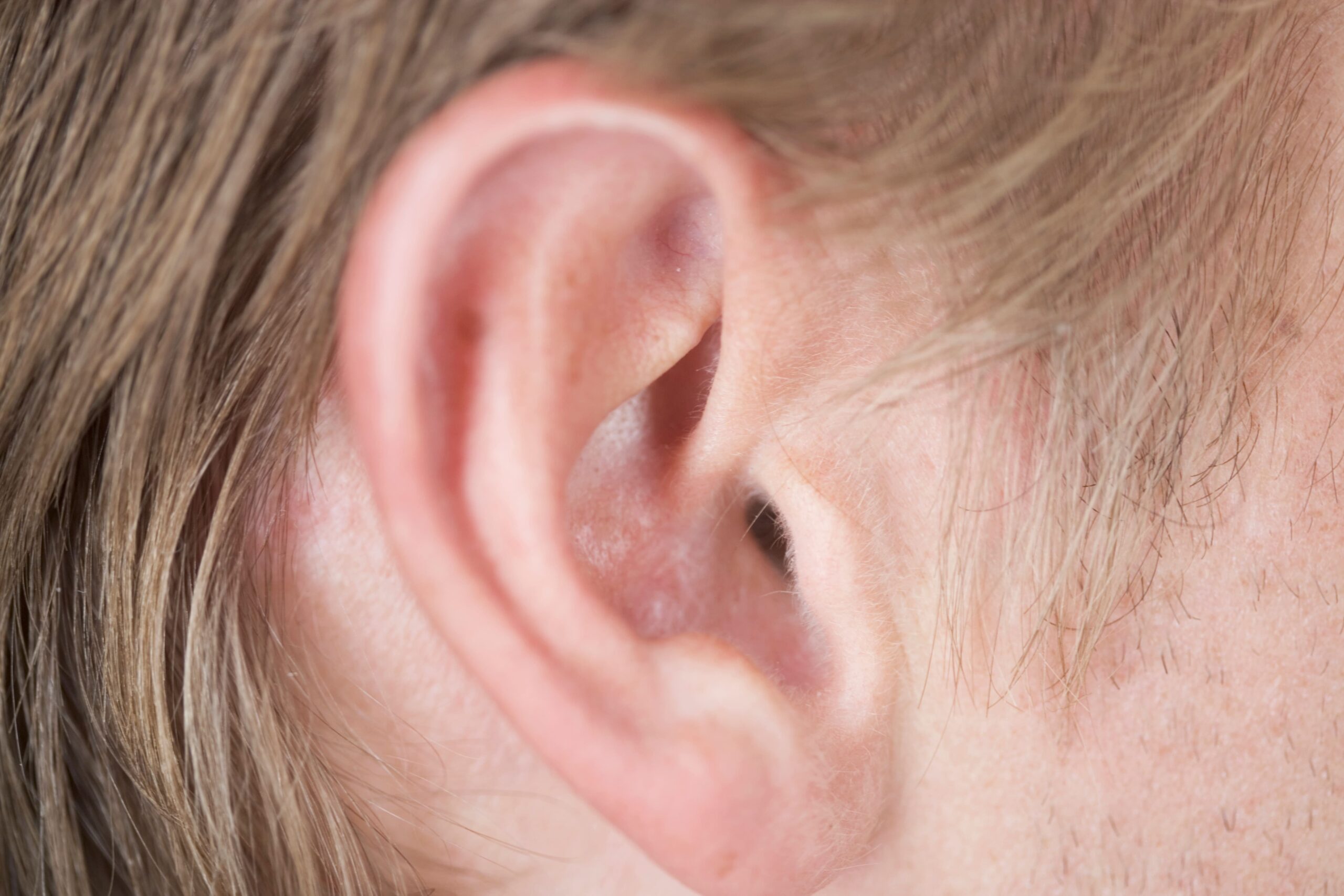 Image Swimmer’s Ear