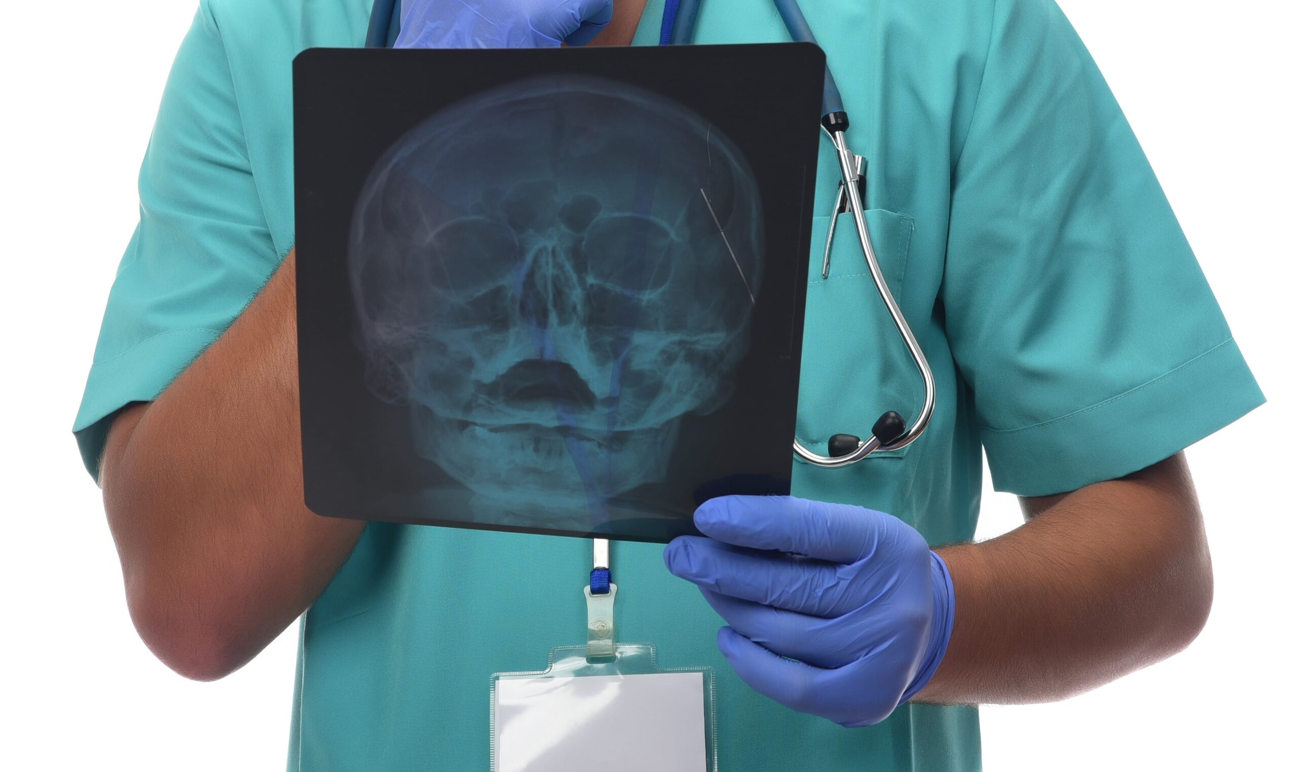 Image chronic cough sinus diagnosis