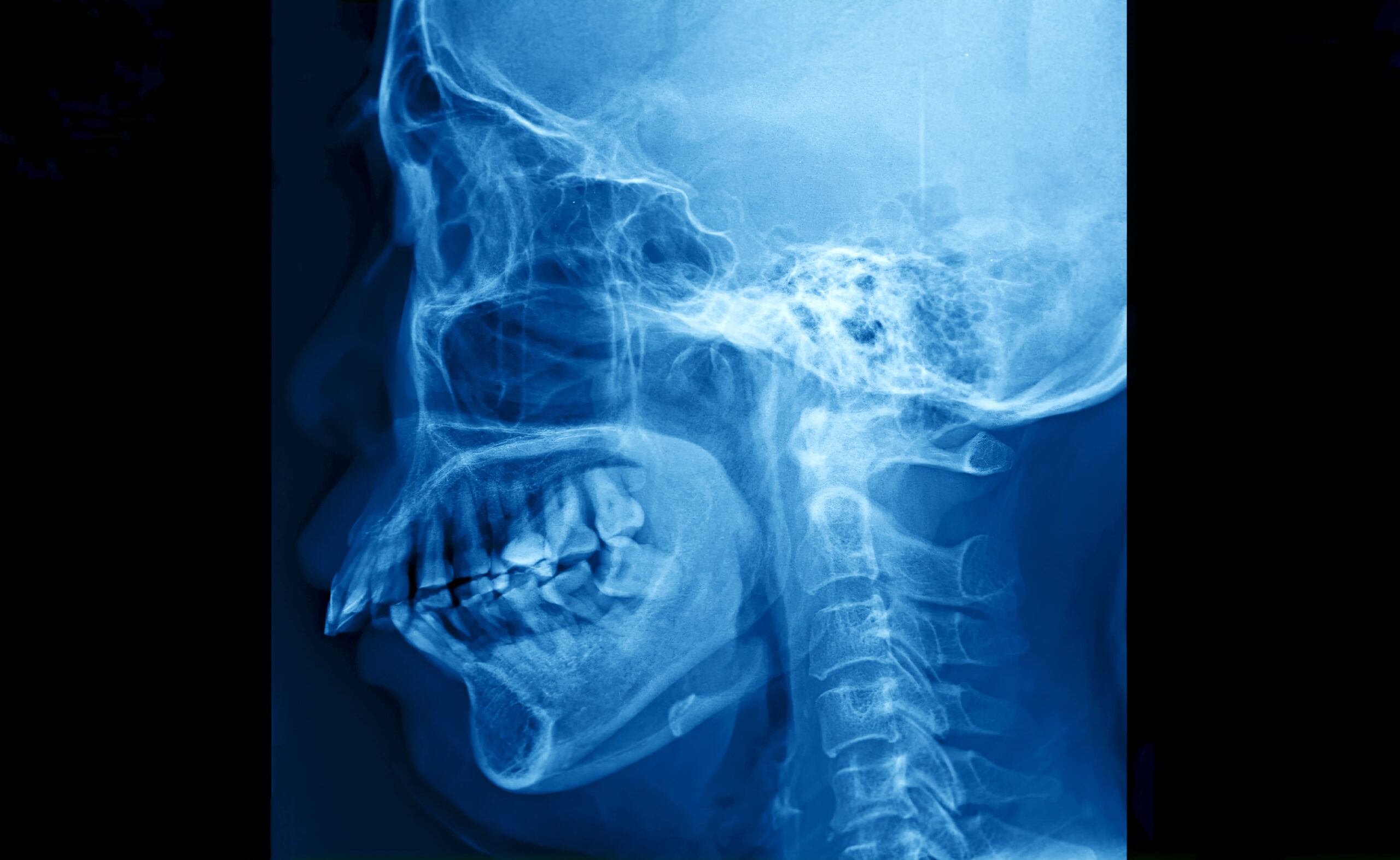 Image throat trauma diagnosis
